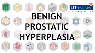 Benign Prostatic Hyperplasia