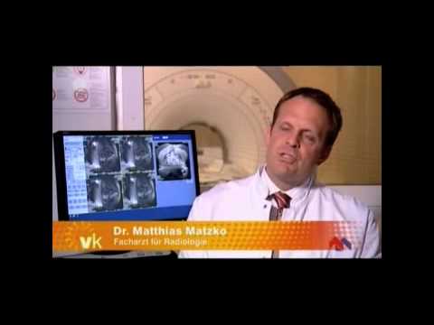 Postoperativen Phase der Operation der Prostata-Adenom zu entfernen Aneurysma der Prostata