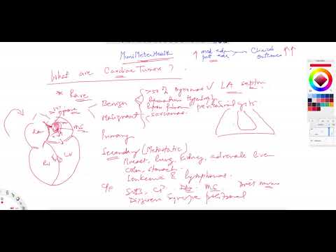 ^MuniSTHealth - #229 What Are Cardiac Tumors?