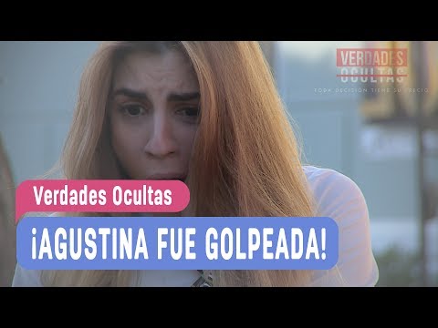 Verdades Ocultas - ¡Agustina fue golpeada! - Agustina y Rocío Capítulo 2