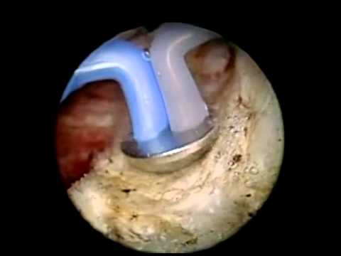 massaggio perineo orgasmo prostatico