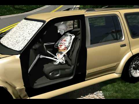 Ground Vehicle | Accident Reconstruction | Demonstratives Ground Vehicle | Accident Reconstruction | Demonstratives