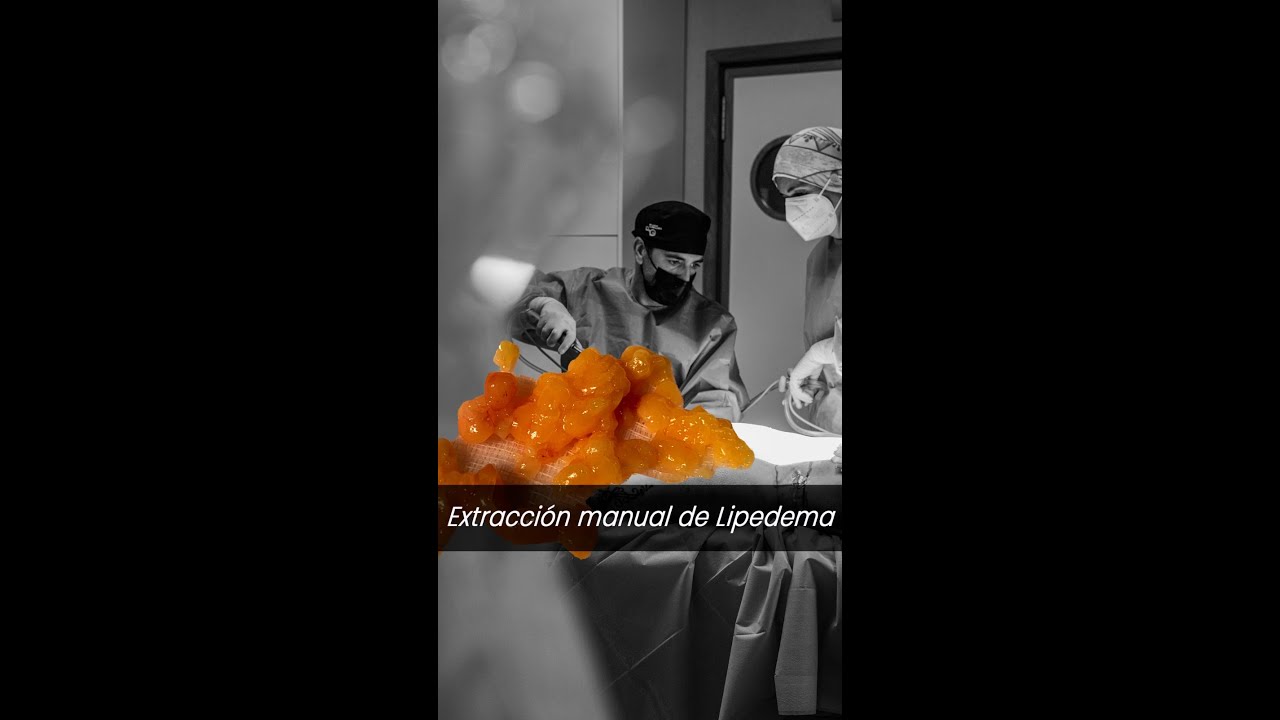 Alexo Carballeira Braña-10