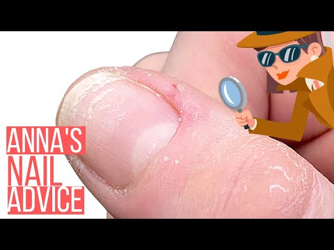 HORRIBLE CUTICLES?This info will change everything! 🤯[ANNA’S NAIL ADVICE]