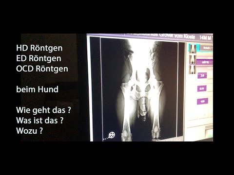 Creme Gelenke billigsten Schmerzen im Bereich der Halswirbelsäule lindern
