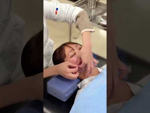 美容鍼灸を接写してみた　 #鍼灸 #美容 #専門学校