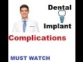 Dental Implant Complications WARNING HIDDEN DANGERS