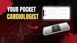 How Accurate Is the AliveCor KardiaMobile 6-Lead EKG Monitor?