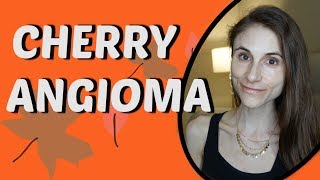 CHERRY ANGIOMA REMOVAL| Q&A WITH DERMATOLOGIST DR DRAY
