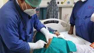 Bone Marrow Aspiration and Biopsy Dr Sandeep Kumar garg Nutema Hospital