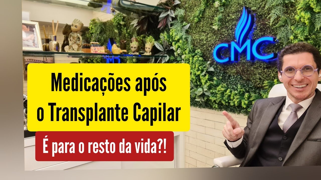 Terei que tratar a calvície o resto da vida depois do Transplante Capilar?