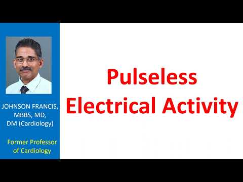 Pulseless Electrical Activity