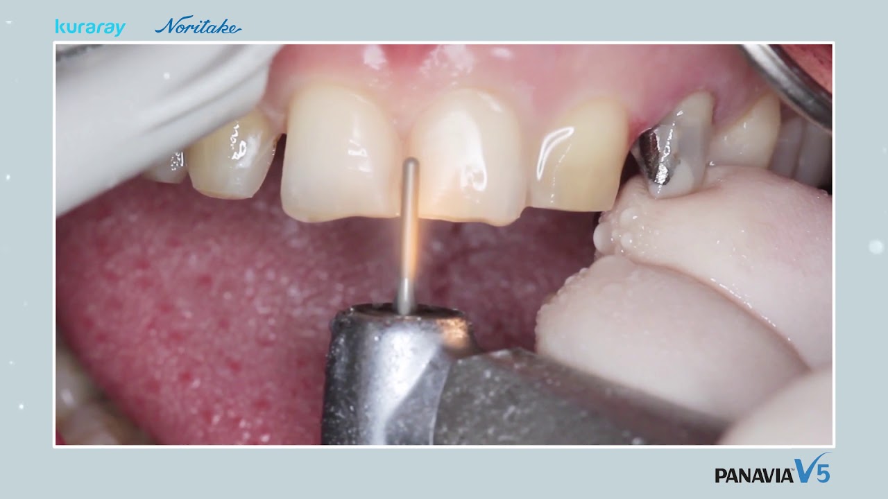 Présentation Panavia V5