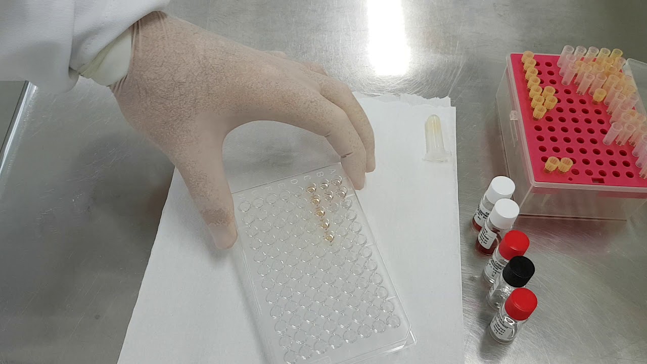 IMUNOLOGIA - Aulas prática de Hemaglutinação indireta, parte 2 (leitura)