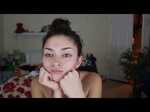 Ефикасно прикриване на акне с грим