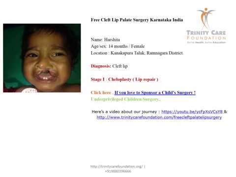 Gift a Smile to 75 Cleft Children in India
