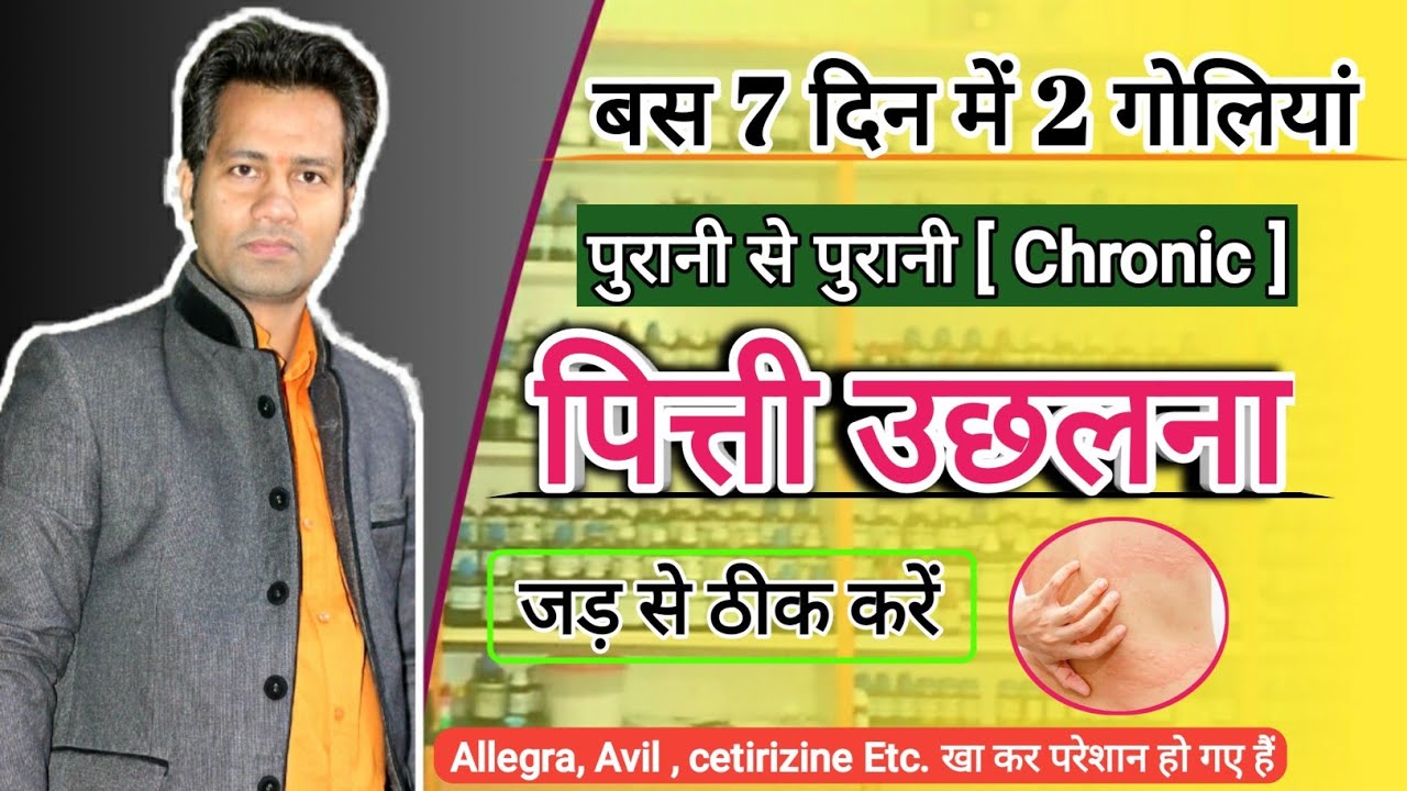 Watch video urticaria treatment | hives on skin|skin allergy|how to cure urticaria | chronic urticaria |Dr tarun Now urticaria treatment | hives on skin|skin allergy|how to cure urticaria | chronic urticaria |Dr tarun