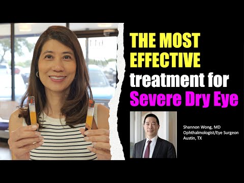 The BEST EYE DROP TREATMENT FOR SEVERE DRY EYES - Serum Tears.  Shannon Wong, MD