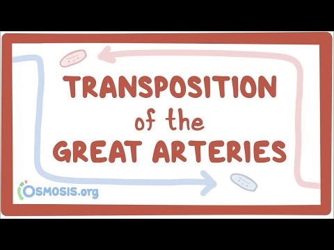 Transposition of the great arteries (TGA) - causes, symptoms, treatment & pathology