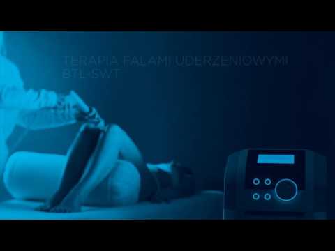 Leczenie koślawego zniekształcenia stawu kolanowego u dzieci Nierówności między palcami u kur