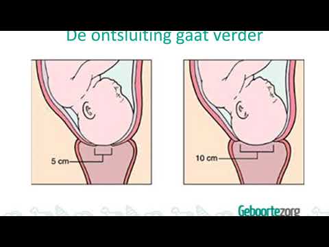 Voorlichtingsfilm: De Bevalling
