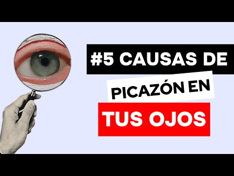 Por estas #5 razones sientes picazón / comezón en tus ojos !