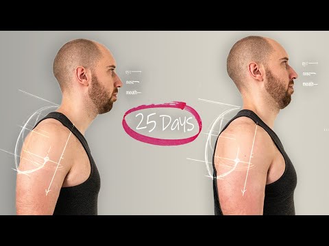 I tried to fix my bad posture in 25 days.