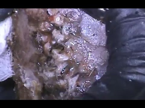 download lagu mp3 mp4 Debridement Traduzione, download mp3 Debridement Traduzione free downloadn, video klip Debridement Traduzione