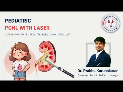 Dr. Prabhu's Pediatric Urology- -PEDIATRIC TUBELESS MINI PCNL-KIDNEY STONES REMOVAL IN CHILDREN