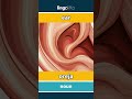 ear - oreja video thumbnail