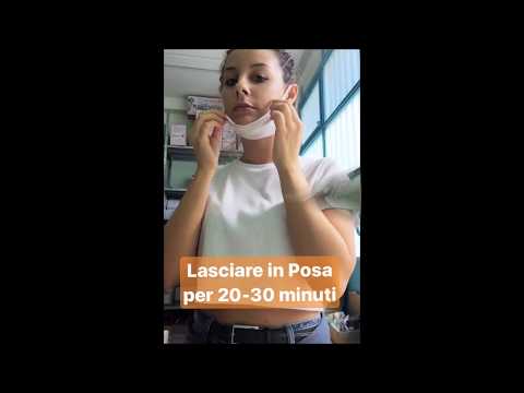 La presentazione a competizione di Sig.a una lentiggine Se è possibile andare a un sunbed se ho lentiggini