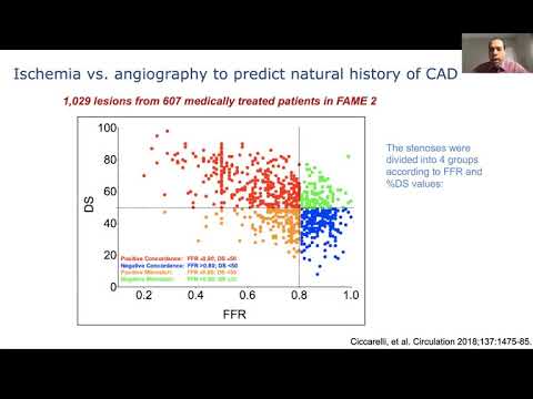 Mohamed A Omer, MD, MSc - Complete Revascularization with Multi-Vessel Coronary Artery Disease