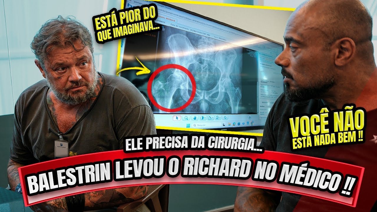 🚨BALESTRIN LEVOU O RICHARD NO MÉDICO - ELE VAI PRECISAR OPERAR !