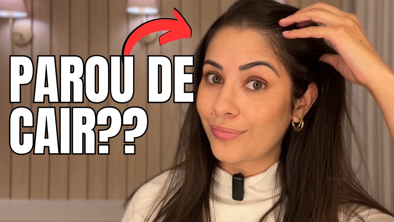 Um Ano de Tratamento com Minoxidil em Cápsulas: Minha Jornada Contra a Alopecia Androgenética!