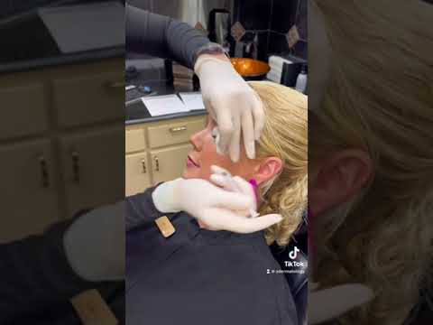 It’s Botox Day for the Z Team 💜