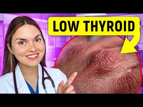 15 Signs of HYPOTHYROIDISM You Can See: Doctor Explains