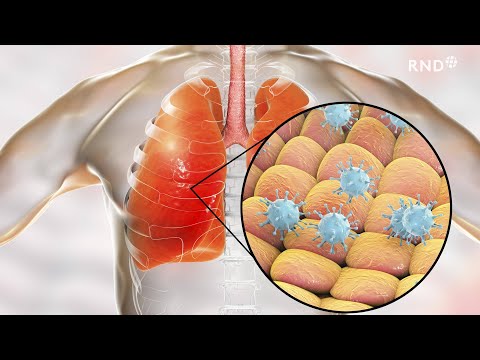 Schnell erklärt: Das ist das Coronavirus