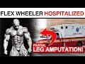 Flex Wheeler Hospitalized - Leg Partially Amputated!