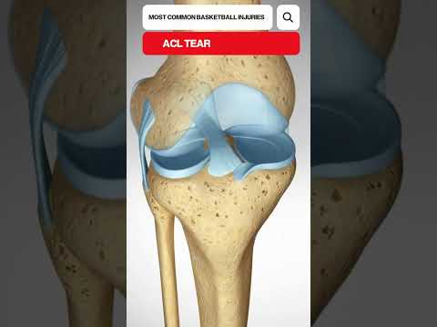 Guess The Spine Injury And Procedure Challenge