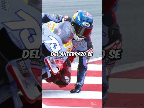 ¿Por qué todos los pilotos de MotoGP tienen esa cicatriz?