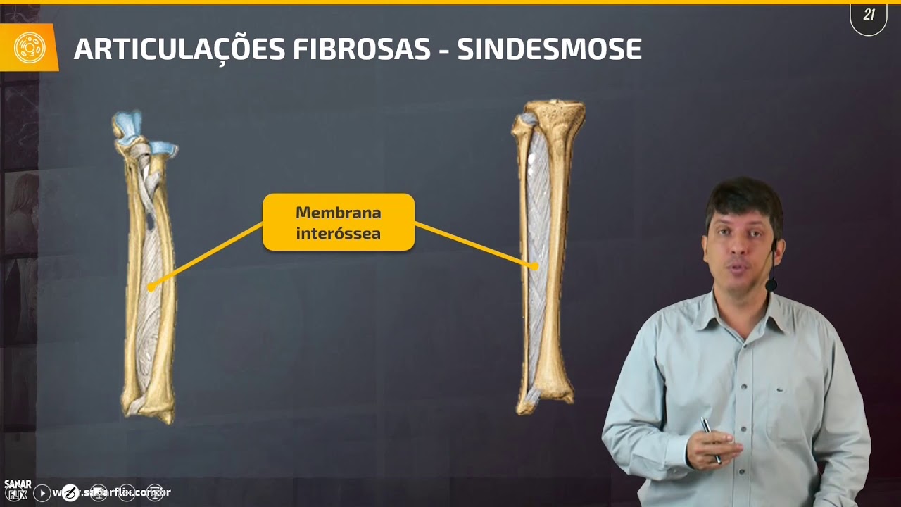 Artrologia - Estudo das articulações - Aula de Sistema Osteomuscular SanarFlix