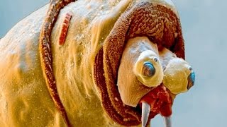 15 Horrifying Microscopic Images
