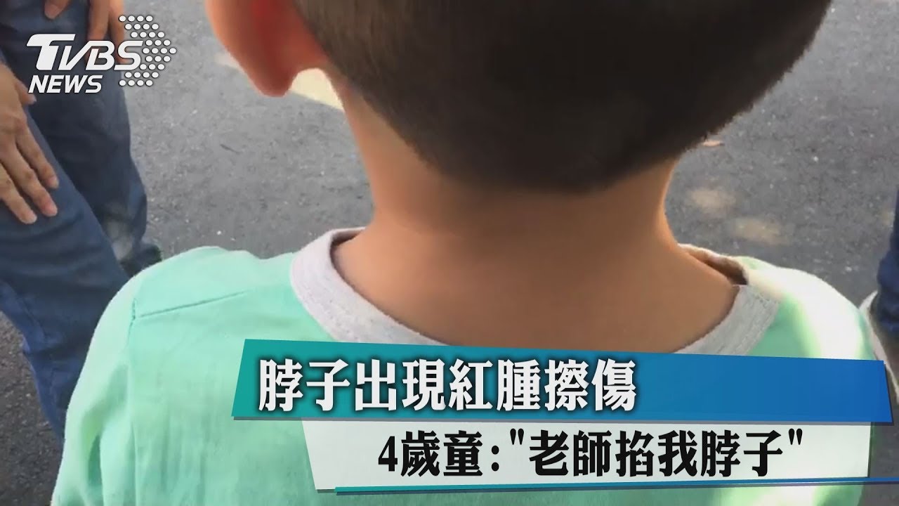 脖子出現紅腫擦傷 4歲童:老師掐我脖子