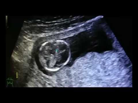 แอพลิเคชัน SDA โรคสะเก็ดเงิน 3 กลากยา nonsteroidal