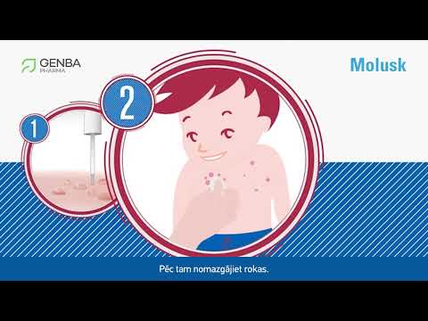 YouTube video par MOLUSK 10% šķīdums, 3 g