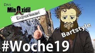 Das Minoxidil Experiment #Woche19 Ein bisschen Bartstyle und Geschichte