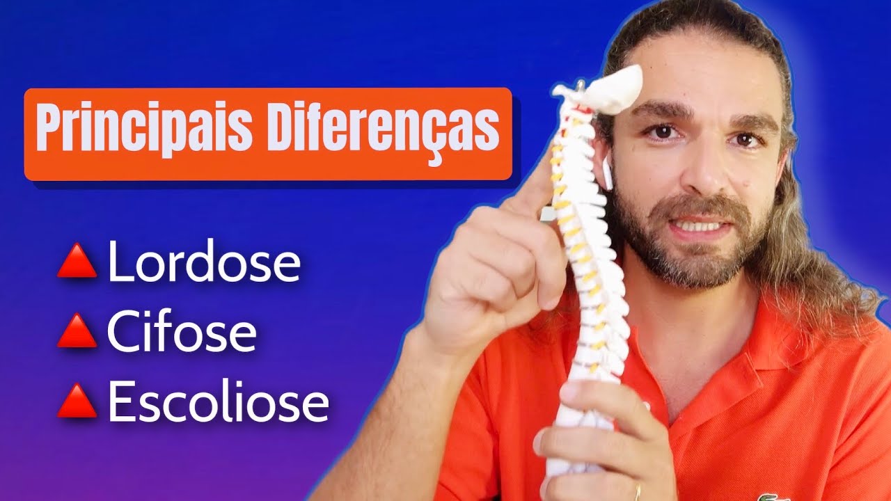 O Que é Lordose, Cifose e Escoliose