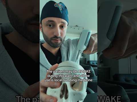 How a brain surgeon drills into the skull. #neurosurgery #doctor #medical #medtok #doctorexplains