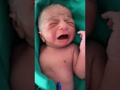 Baby crying |#babies #love #cryingbaby #drpoonammaggo