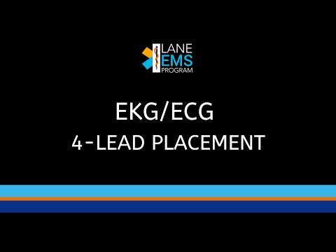 EKG/ECG - 4-Lead Placement